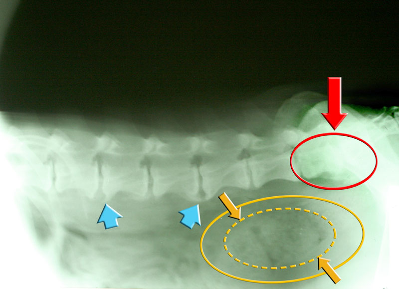 Syndrom cauda equina (SCE)