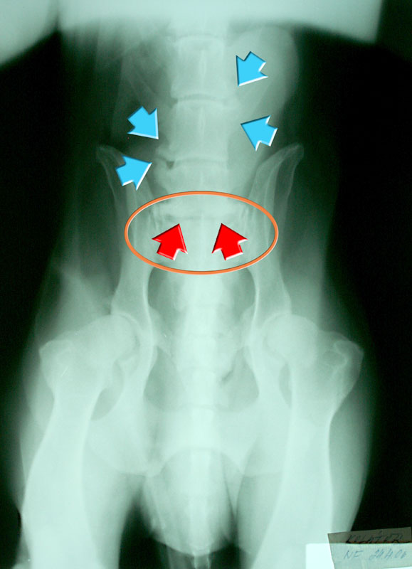 Syndrom cauda equina (SCE)